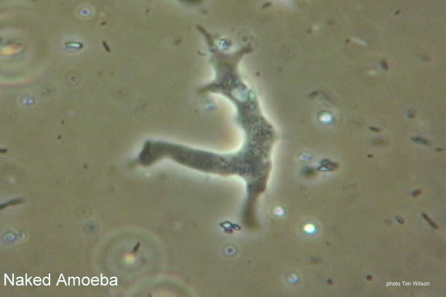 Naked Amoeba