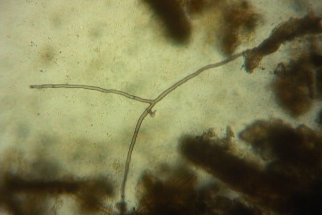 fungal hyphae2